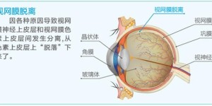 上海眼科医生姚宜：老年上网需适度，警惕上瘾玩脱“网”