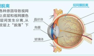 上海眼科医生姚宜：老年上网需适度，警惕上瘾玩脱“网”