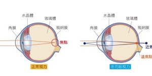 老花眼只能戴眼镜吗？不！上海眼科院长告诉你这种方法告别老花镜！